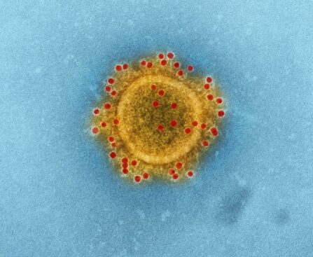 Deadly Waves: The Resurgence of Human Metapneumovirus (HMPV) in NSWDeadlyWaves,Resurgence,HumanMetapneumovirus,HMPV,NSW