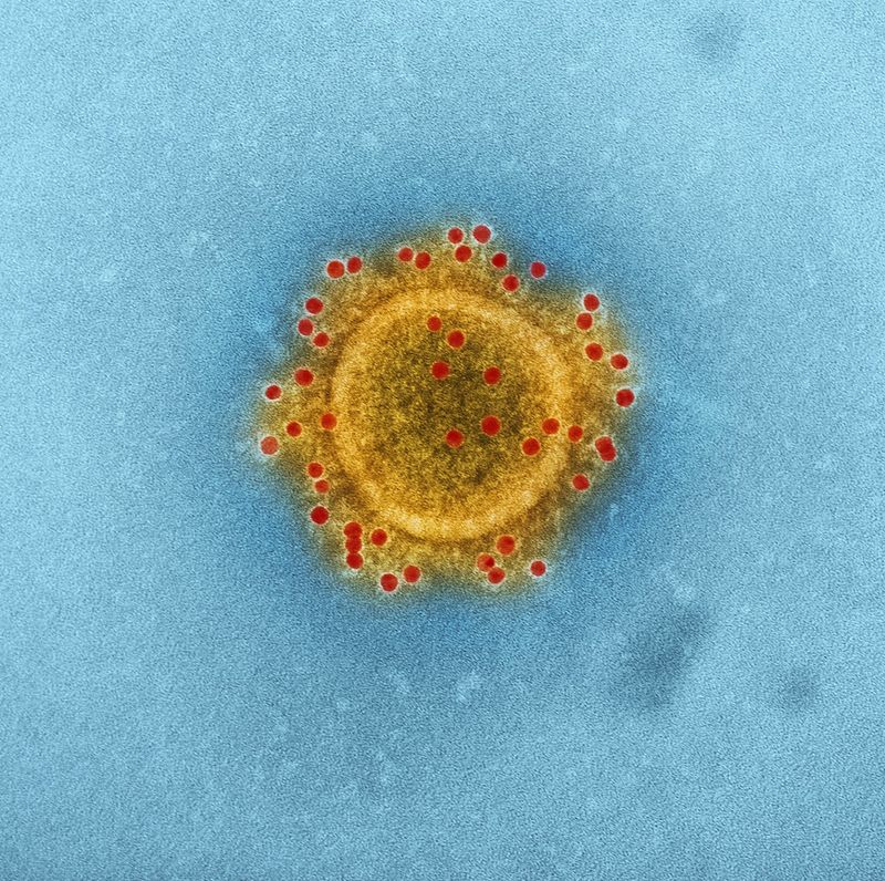 Deadly Waves: The Resurgence of Human Metapneumovirus (HMPV) in NSWDeadlyWaves,Resurgence,HumanMetapneumovirus,HMPV,NSW